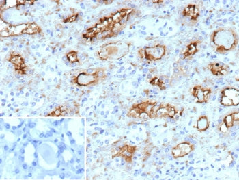 IHC staining of FFPE human kidney tissue with PD-Ibeta antibody (clone ENPP3/9892). Inset: PBS used