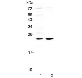Western blot testing of 1) rat heart and 2) mouse heart tissue lysate with Il6 antibody at 0.5ug/ml.