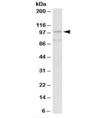 ACTN1 Antibody