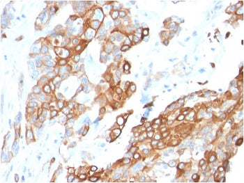 Neuregulin-1 Antibody / NRG1