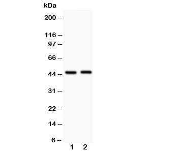 Beta Arrestin 2 Antibody
