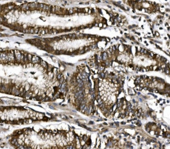 CISD1 Antibody / MitoNEET