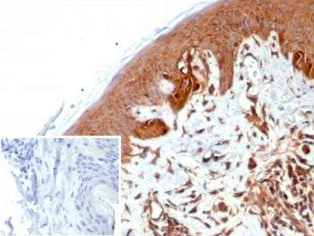 IHC staining of FFPE human skin tissue with Nucleoside diphosphate kinase B antibody (clone NME2/643