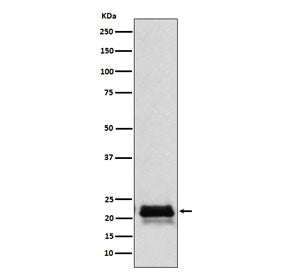 Western blot testing of human pituitary lysate with FSH beta antibody. Expected molecular weight: 17