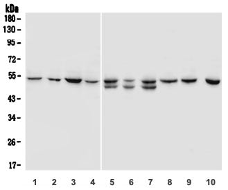 SOX11 Antibody