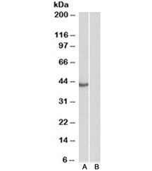 TBP Antibody