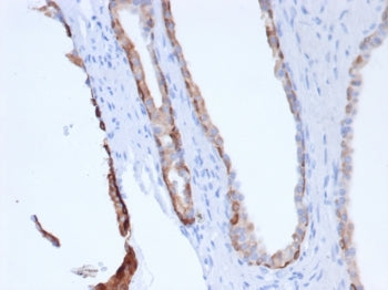 IHC staining of FFPE human prostate tissue with recombinant Pan-CK antibody (clone rPCK/6750). HIER: