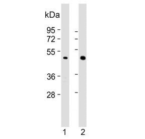 Western blot testing of human 1) A431 and 2) NCI-H460 cell lysate with Brachyury antibody. Predicted