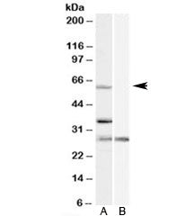 PRPF31 Antibody