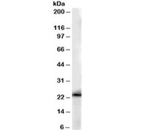 GSTP1 Antibody