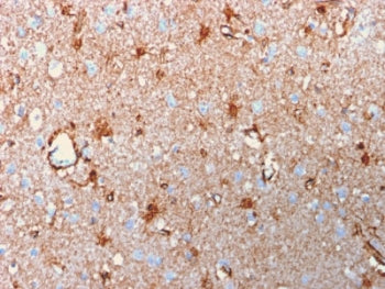 S100B Antibody
