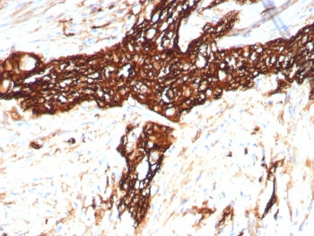 NCAM / CD56 Antibody