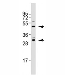 Western blot testing of Shh antibody at 1:1000 dilution + mouse stomach lysate; Predicted molecular