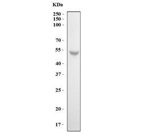 MMP13 Antibody / Collagenase 3