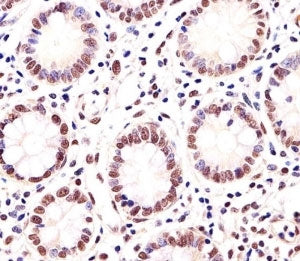 Immunohistochemical analysis of paraffin-embedded human small intestine using MGMT antibody at 1:25