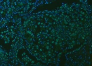 U2 snRNP A Antibody / SNRPA1