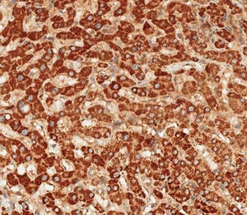 ATG7 Antibody / APG7