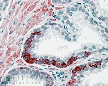 IHC staining of FFPE human prostate with ADAM12 antibody at 4ug/ml. HIER: steamed with pH6 citrate b