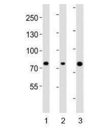 Western blot analysis of lysate from human 1) ovary, 2) placenta and 3) plasma lysate using Integrin