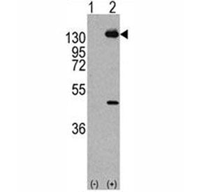 Western blot analysis of PDGFRA antibody and293 cell lysate (2 ug/lane) either nontransfected (Lane