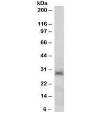 SIRT3 Antibody