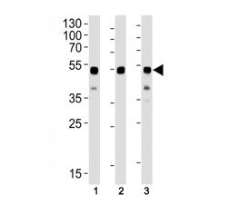 Western blot analysis of lysate from (1) CEM, (2) HL-60 and (3) SH-SY5Y cell lines using GATA3 antib