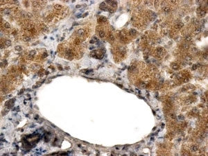 ALDH3A2 Antibody