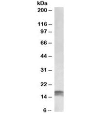 CDKN2A Antibody (pancreatic)