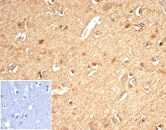 IHC staining of FFPE human brain tissue with recombinant Aldose reductase antibody (clone AKR1B1/701