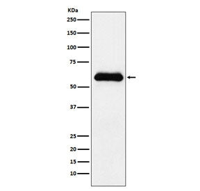 Alpha-1-Antichymotrypsin Antibody / AACT / SERPINA3