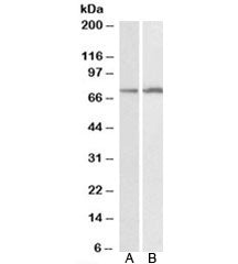 CYP2B6Antibody