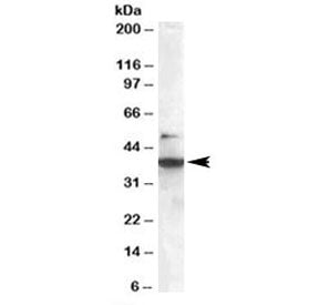 SH3GLB1 Antibody