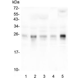 RHOB Antibody