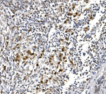 POLR2A Antibody / RNA polymerase II subunit RPB1