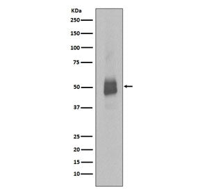 Phospho-LYN Antibody (pY396)