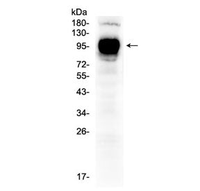 Western blot testing of human HepG2 cell lysate with CD119 antibody at 0.5ug/ml. Predicted molecular