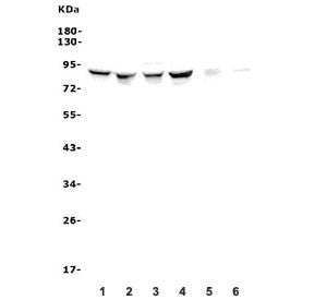 ALDH18A1 Antibody / P5CS