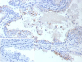 MRP4 Antibody / ABCC4