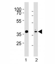 Western blot analysis of lysate from mouse stomach, rat heart tissue (left to right) using Mouse Nkx