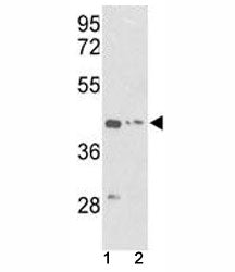 Actin Antibody (gamma, ACTG1)