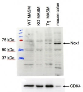 Western blot testing of transgenic mouse aortic smooth muscle (MASM) cell lysate with NOX1 antibody