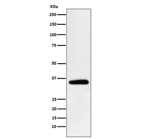 PDHB Antibody / Pyruvate Dehydrogenase E1 beta subunit