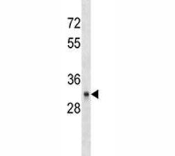 CD40 Antibody