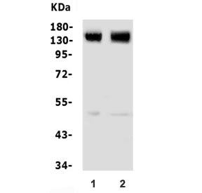 Glutamate Metabotropic Receptor 5 Antibody / GRM5