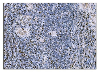 FosB Antibody
