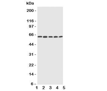 Western blot testing of CYP2U1 antibody and Lane 1: HeLa; 2: MCF-7; 3: MM453; 4: COLO320; 5: HT1080