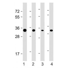 STUB1 Antibody (C-Terminal Region)