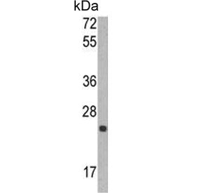 TIMP1 Antibody