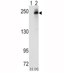 Anaplastic Lymphoma Kinase Antibody (ALK)
