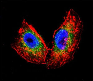 Acetylcholinesterase Antibody / ACHE